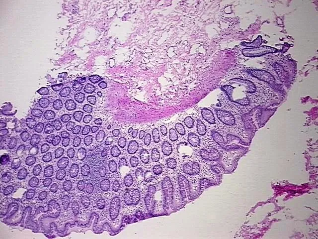 Tissue Genomic DNA, Rectum - image 1