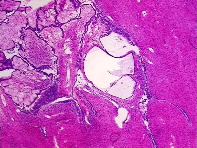Tissue Genomic DNA, Ovary: right - image 1