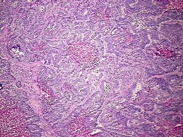Tissue Genomic DNA, Rectum - image 1