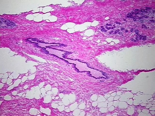 Tissue Genomic DNA, Breast - image 1