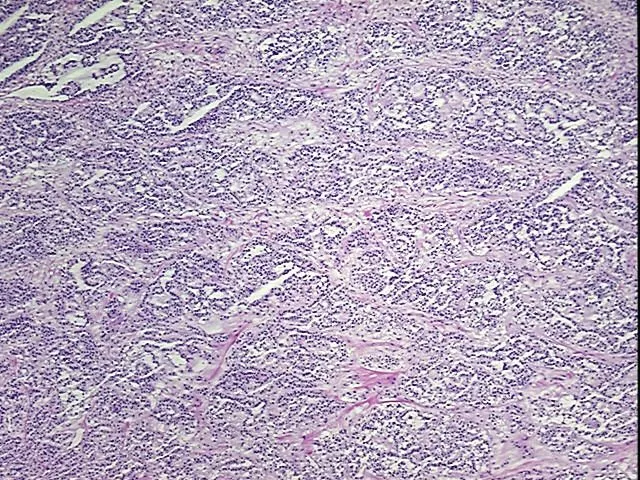 Tissue Genomic DNA, Ovary - image 1