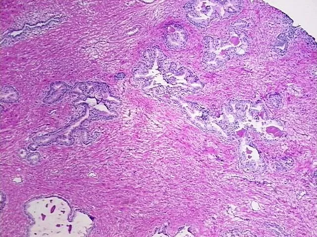 Tissue Genomic DNA, Prostate - image 1