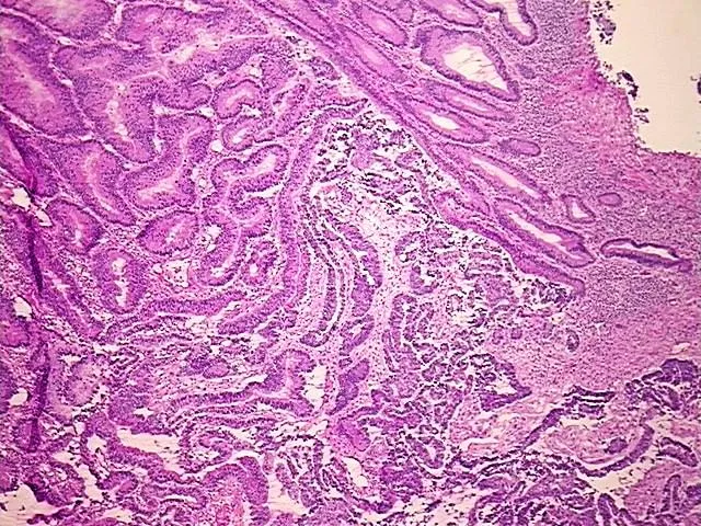 Tissue Genomic DNA, Cecum - image 1