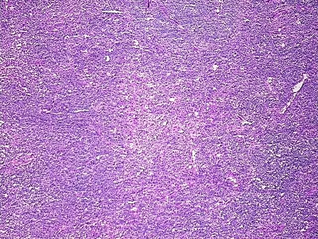 Tissue Genomic DNA, Lymph node - image 1