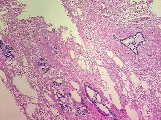 Tissue Genomic DNA, Breast - image 1