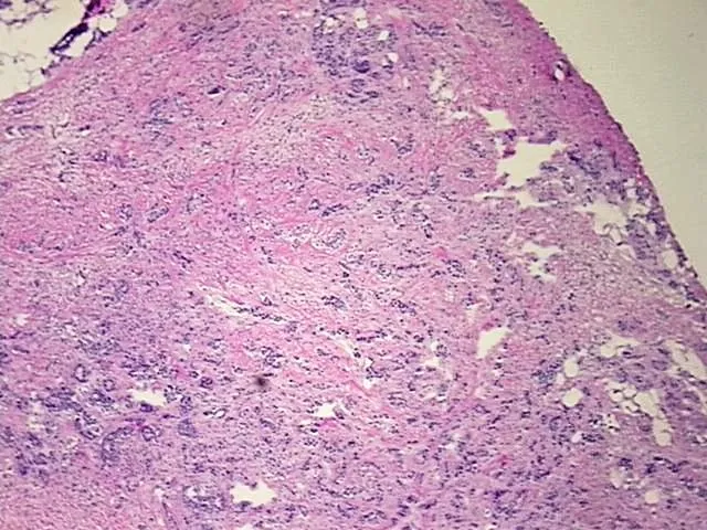Tissue Genomic DNA, Breast - image 1