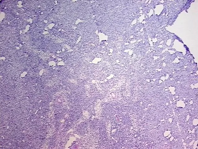 Tissue Genomic DNA, Lymphoid tissue - image 1