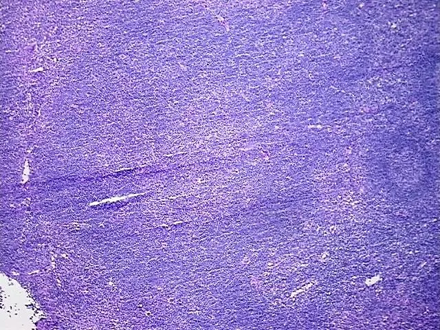 Tissue Genomic DNA, Lymph node - image 1