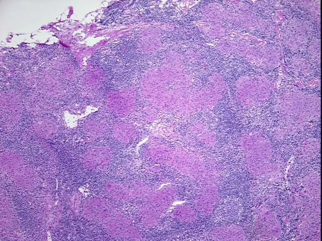 Tissue Genomic DNA, Lymph node - image 1