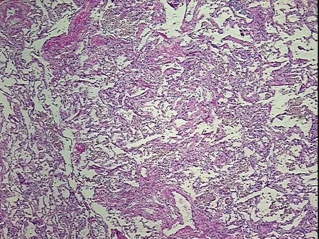 Tissue Genomic DNA, Lung - image 1
