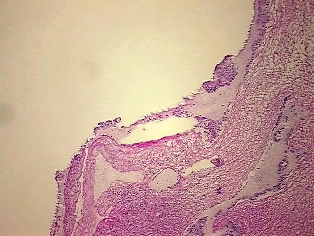 Tissue Genomic DNA, Ovary: right - image 1