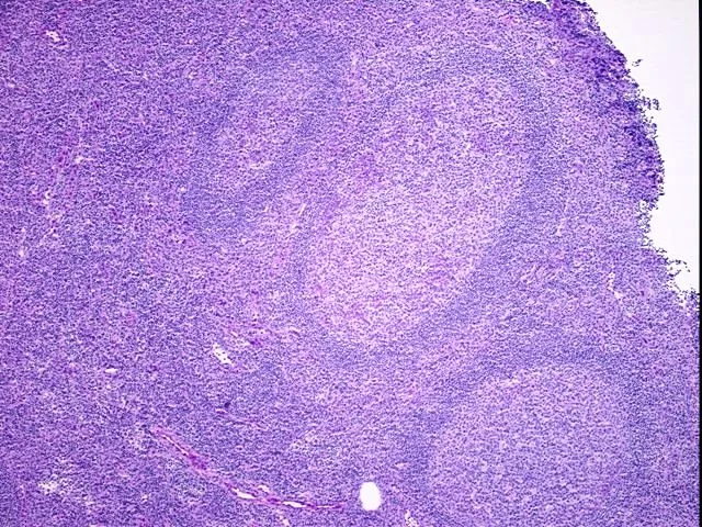 Tissue Genomic DNA, Lymph node - image 1