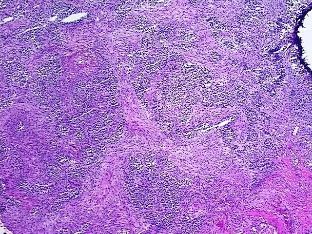 Tissue Genomic DNA, Lung - image 1