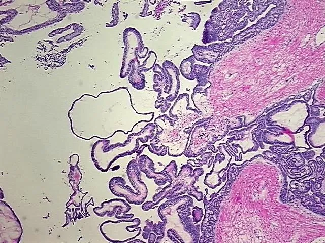 Tissue Genomic DNA, Ovary: bilateral - image 1