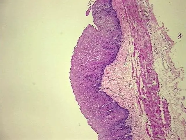 Tissue Genomic DNA, Esophagus - image 1