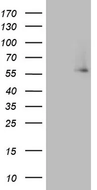 IKZF3 Mouse Monoclonal Antibody [Clone ID: OTI1E1] - image 1