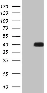 ATF1 Mouse Monoclonal Antibody [Clone ID: OTI7H3] - image 1