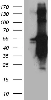TANK Mouse Monoclonal Antibody [Clone ID: OTI1G2] - image 1
