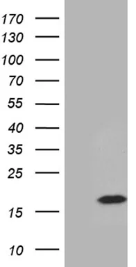 PRELID2 Mouse Monoclonal Antibody [Clone ID: OTI3B7] - image 1