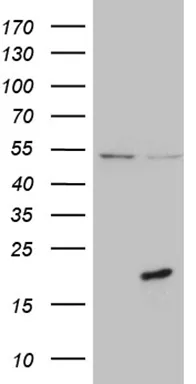 PRELID2 Mouse Monoclonal Antibody [Clone ID: OTI2F6] - image 1