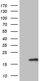 PRELID2 Mouse Monoclonal Antibody [Clone ID: OTI8F1] - image 1