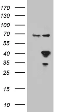 Apolipoprotein L 1 (APOL1) Mouse Monoclonal Antibody [Clone ID: OTI1D8] - image 1
