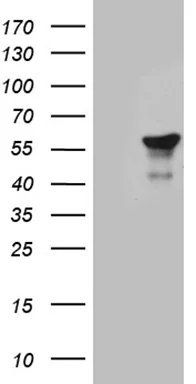 DP2 (TFDP2) Mouse Monoclonal Antibody [Clone ID: OTI7B6] - image 1