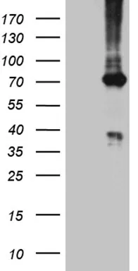 PGM2L1 Mouse Monoclonal Antibody [Clone ID: OTI4G6] - image 1