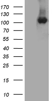 Cellular Apoptosis Susceptibility (CSE1L) Mouse Monoclonal Antibody [Clone ID: OTI4G1] - image 1