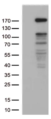 NEDD4 Mouse Monoclonal Antibody [Clone ID: OTI6E12] - image 1