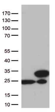 TAGLN2 Mouse Monoclonal Antibody [Clone ID: OTI7A5] - image 1