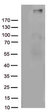 Complement C4B (C4B) Mouse Monoclonal Antibody [Clone ID: OTI1B2] - image 1