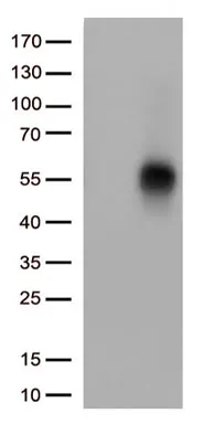 TNFRSF14 Mouse Monoclonal Antibody [Clone ID: OTI5C5] - image 1