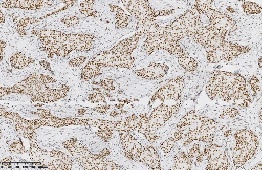 MSH2 Mouse Monoclonal Antibody [Clone ID: OTI10F7] - image 1