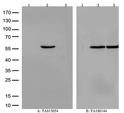 CYP21A2 Mouse Monoclonal Antibody [Clone ID: OTI3D1] - image 1
