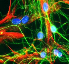 MAP2 Chicken Polyclonal Antibody - image 1
