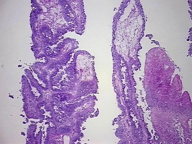 Tissue Total RNA, Ovary - image 1