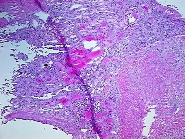 Tissue Total RNA, Thyroid gland - image 1