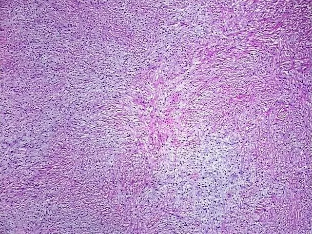 Tissue Total RNA, Soft tissue - image 1