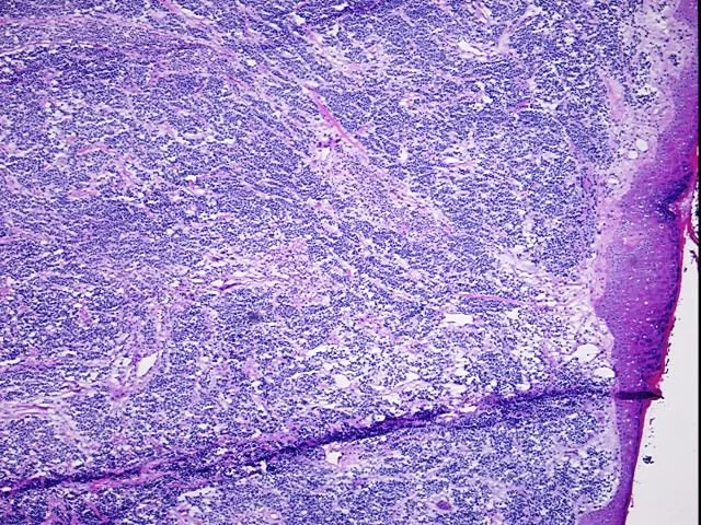 Tissue Total RNA, Skin - image 1