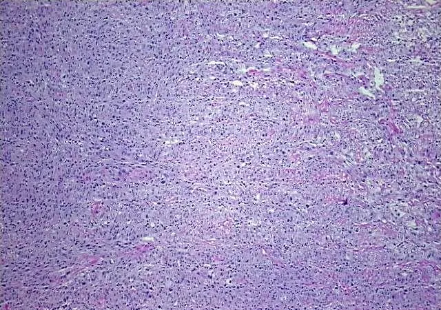 Tissue Total RNA, Soft tissue - image 1