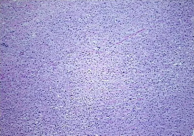 Tissue Total RNA, Soft tissue - image 1