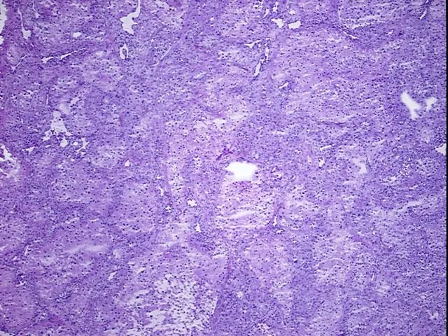 Tissue Total RNA, Kidney - image 1