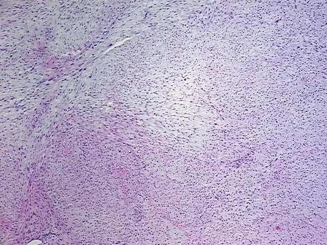 Tissue Total RNA, Soft tissue - image 1