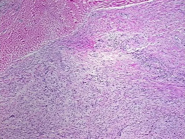 Tissue Total RNA, Soft tissue - image 1