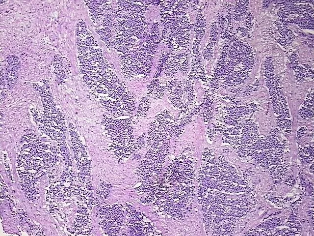 Tissue Total RNA, Endometrium - image 1
