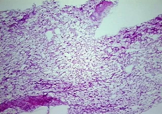 Tissue Total RNA, Soft tissue - image 1
