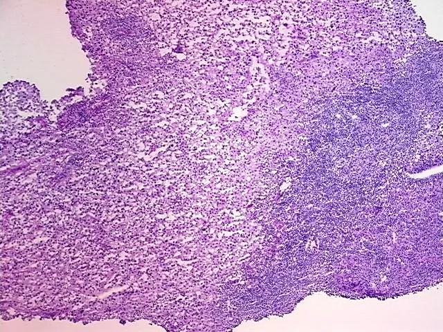 Tissue Total RNA, Skin - image 1