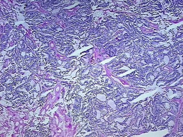 Tissue Total RNA, Thyroid gland - image 1