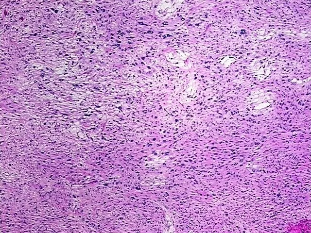Tissue Total RNA, Soft tissue - image 1